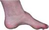 this is what my feet look like
